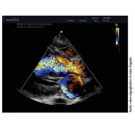 GE Ultrasound Machine - GE Logiq C5 Premium Ultrasound Machine Trader ...