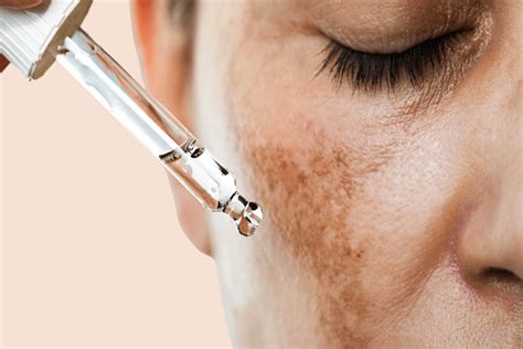 Cosmo Hair & Skin Clinic | +919821062372 | Cosmo Hair & Skin Clinic ...