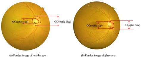 BEAC-Net: Boundary-Enhanced Adaptive Context Network for Optic Disk and ...