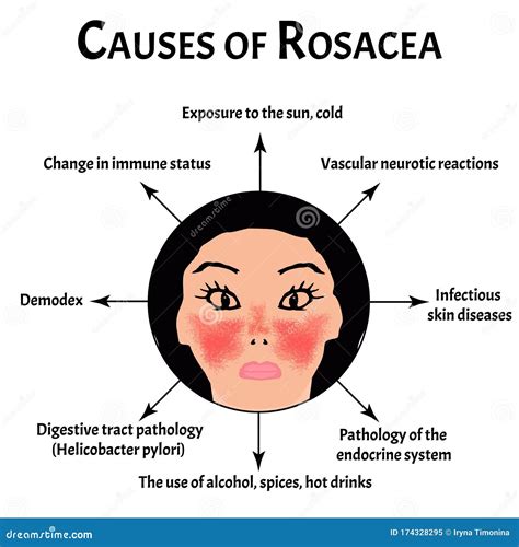 What Happens If Rosacea Is Left Untreated