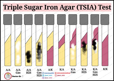 Triple sugar Iron agar (TSIA) Test - Overview