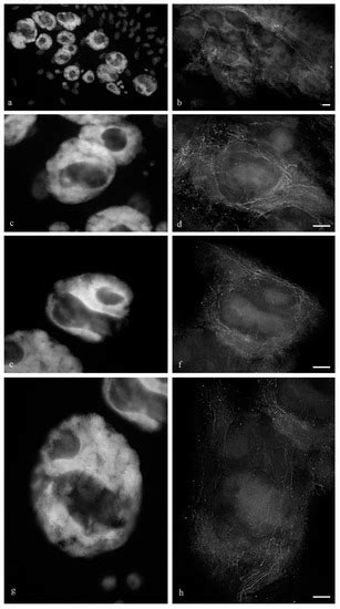 Wheat Antipodal Cells with Polytene Chromosomes in the Embryo Sac Are ...