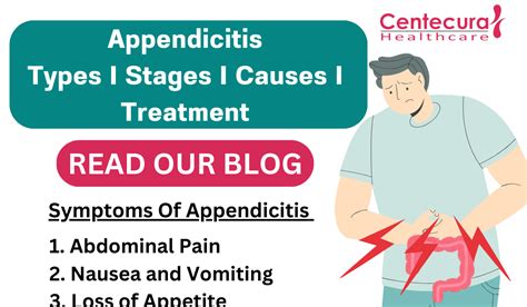Image result for Different Types of Appendicitis