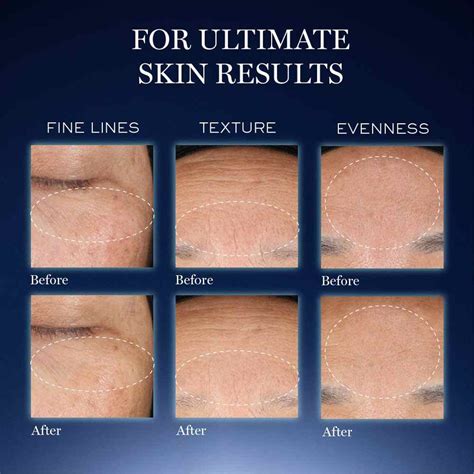 Genifique Ultimate Youth Activating Serum With Beta Glucan For Skin ...