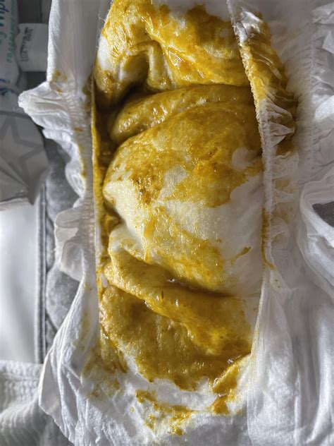 11 week old always had mucous in stool : r/MSPI