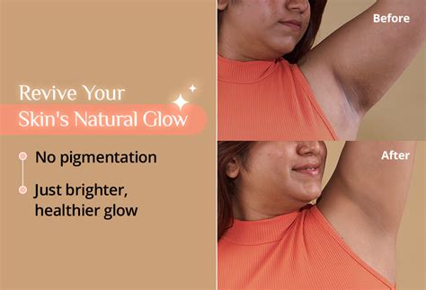 Carmesi Revive Deodorant – Best Pigmentation Removal Roll On