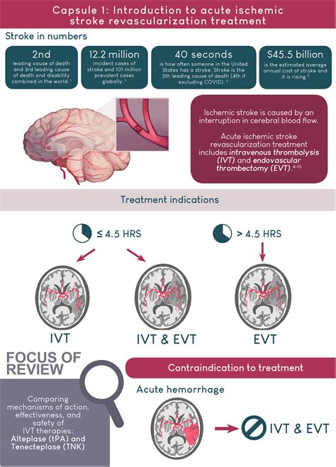 Alteplase or tenecteplase for thrombolysis in ischemic stroke: An ...