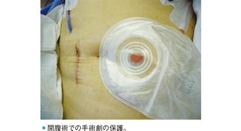 Image result for Dashed Line Single Loop