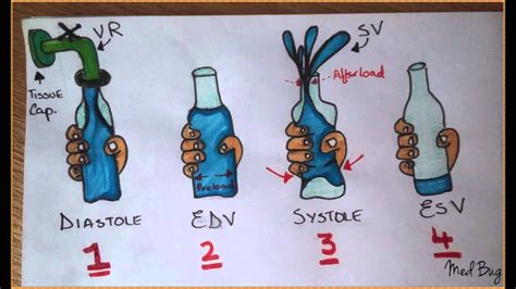 SV, Preload, Afterload, Venous Return, EDV & ESV. | Cardiac nursing ...