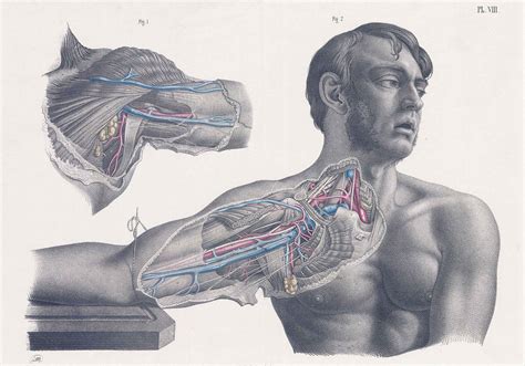1856 SURGICAL ANATOMY Dissection Neck Shoulder Axilla Maclise (SA-44) by MACLISE, JOSEPH ...