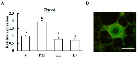 TRPV4 Increases the Expression of Tight Junction Protein-Encoding Genes ...