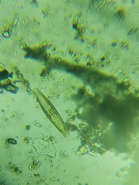 Pond Algae Under Microscope Fresh Pond Water Plankton Algae Microscope