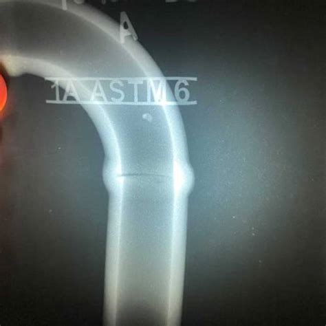 Radiography Testing Services in Pune, Radiography Testing X-ray ...