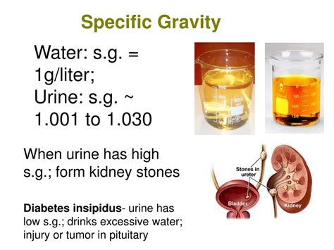 PPT - The Urinary System PowerPoint Presentation, free download - ID ...
