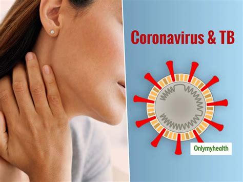 TB And Coronavirus: Extra Care For TB Patients During COVID-19 Outbreak ...