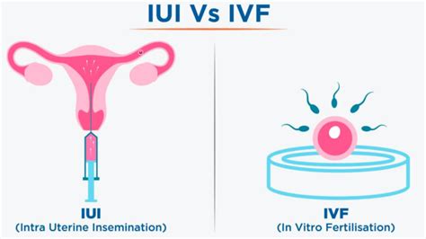 Donor sperm IUI/IVF - Sparsh Meditunes Hospital