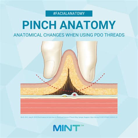 Image result for Parallel Threads Anatomy