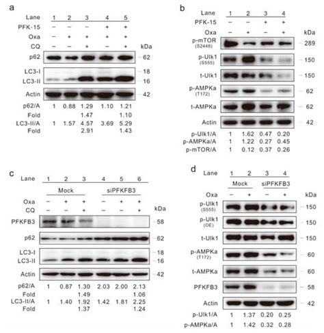 PFKFB3 Inhibition Attenuates Oxaliplatin-Induced Autophagy and Enhances ...