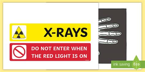 Toy Hospital X Ray Display Signs (teacher made) - Twinkl