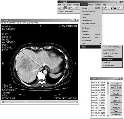 Image result for Computer Assistant Image Analysis ImageJ