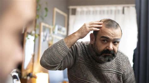 Hair Regrowth: ধীরে ধীরে টাক পড়ে যাচ্ছে? প্রতিদিন এই ৬ কাজ করলে, ফিরে ...