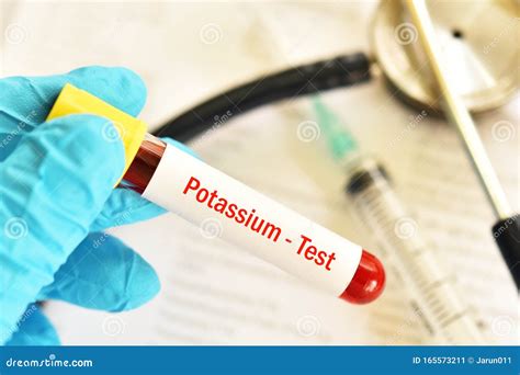 Blood Sample for Potassium Test Stock Image - Image of checkup, renal ...