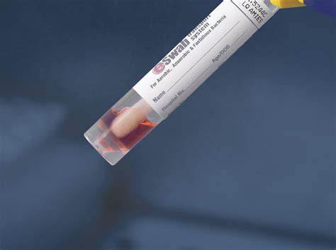 Labcorp Mrsa Nasal Swab at Xavier Brill blog