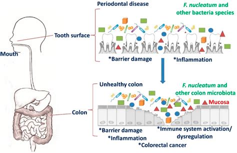 Targeting Programmed Fusobacterium nucleatum Fap2 for Colorectal Cancer ...