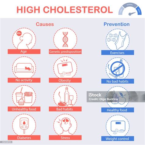 Ilustración de Infografía De Los Síntomas Y Causas Del Colesterol Alto Póster De Información ...