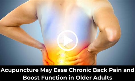 Acupuncture May Ease Chronic Back Pain and Boost Function in Older ...