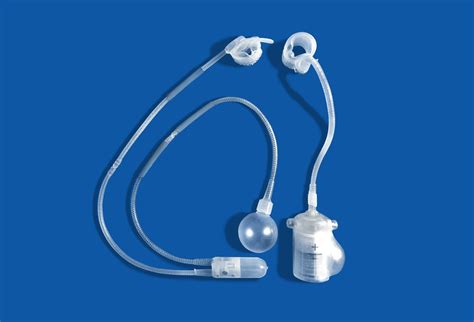 Artificial Urinary Sphincter Placement - Men's Health Alaska