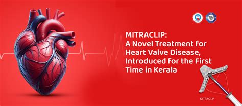 Best Heart Treatment- Top Hospital for Cardiac Surgery in Calicut ...