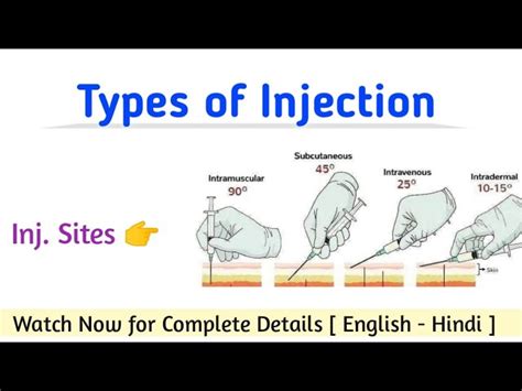 Injection Types 的图像结果