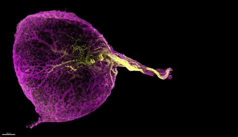 Human yolk sac performs functions of multiple organs, Cambridge and Newcastle researchers discover