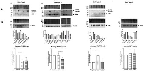 The Proteome Signatures of Fibroblasts from Patients with Severe ...