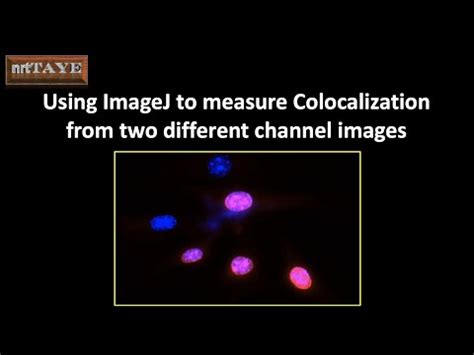 Image result for ImageJ Colocalization Coloc