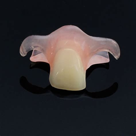 Single Tooth Removable Partial Denture