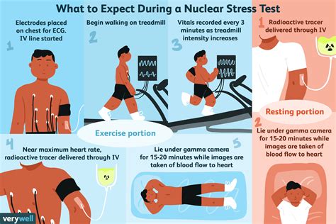 Nuclear Stress Test: Uses, Procedure, Results