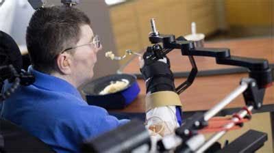 Groundbreaking-Quadriplegic man regains use of arm in medical first