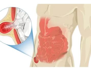 Laparoscopy | DR.RADHIKA MULTI SPECIALITY HOSPITALS AND FERTILITY CENTER