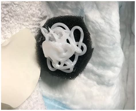 A Diagnostic-Driven Prospective Clinical Study Evaluating the ...