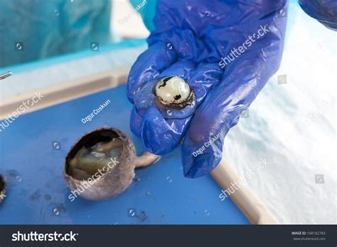 Real Human Eyeball Cut In Half