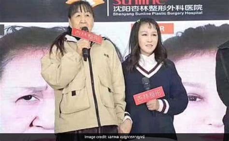 15 साल में बूढ़ी दिखने लगी थी लड़की, इस बीमारी से हुआ ये हाल, अब दिखने ...