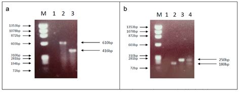 The Role of Culex pipiens L. (Diptera: Culicidae) in Virus Transmission ...