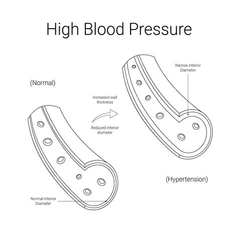 Premium Vector | High blood pressure medical design with line illustration