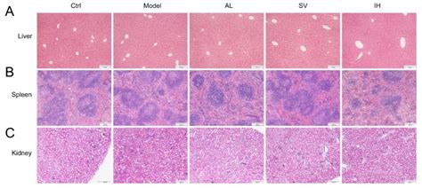 Anti-Gouty Arthritis and Anti-Hyperuricemia Properties of ...