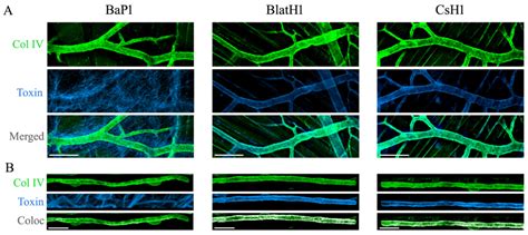 Hemorrhage Caused by Snake Venom Metalloproteinases: A Journey of ...