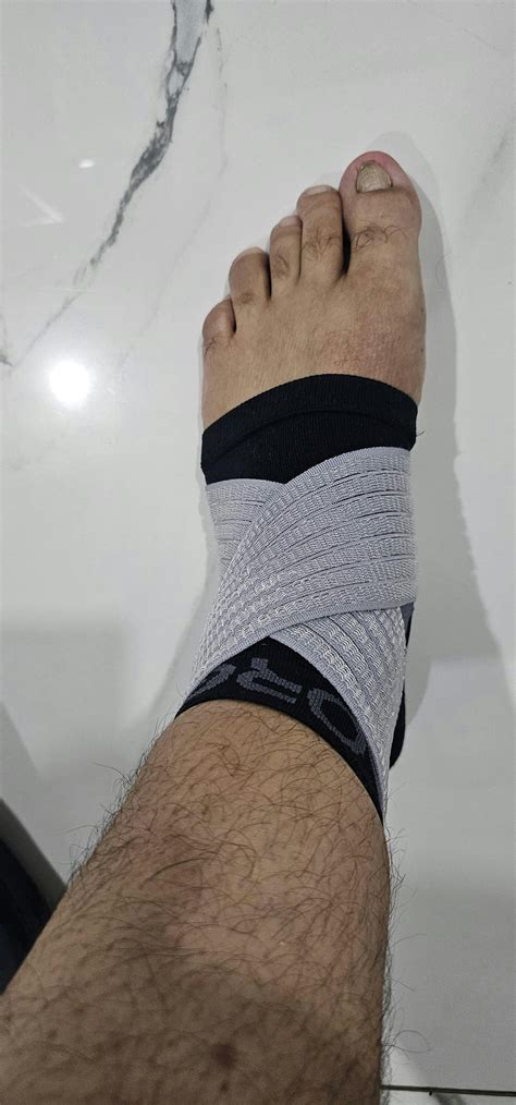 Ankle Guard For Sprained Ankle | Fibula & Tibia Fracture – Sorgen.Co