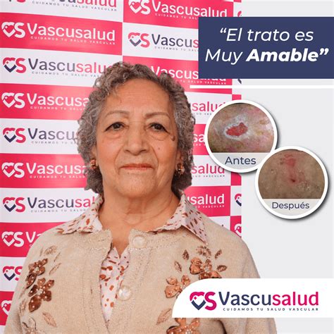 Andrea Tisnado: El trato es muy amable