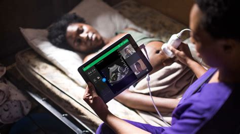 Ultrasound realtime collaboration | Philips